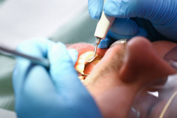 Best Emergency Gum Pain Relief  in Muskegon, MI