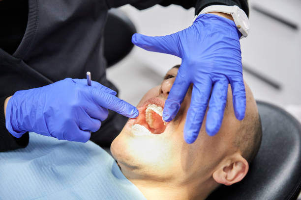 Best Chipped Tooth Repair Near Me  in Muskegon, MI